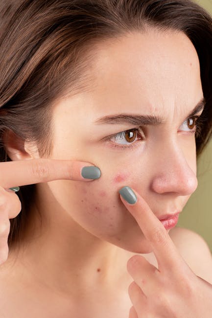 Explore the Best Acne Treatments on Amazon: Rave Reviews & Real Results